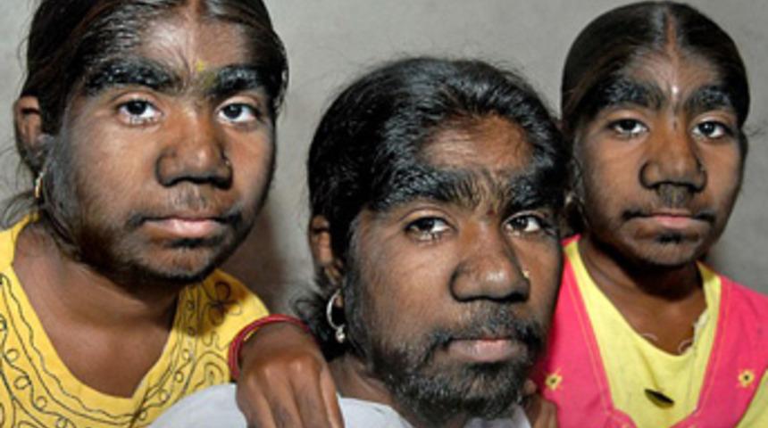 Kurt kızkardeşler şaşırtıyor