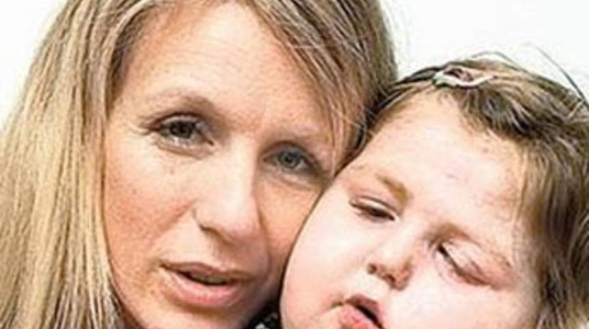 Annenin silikonu kızını kanser etti