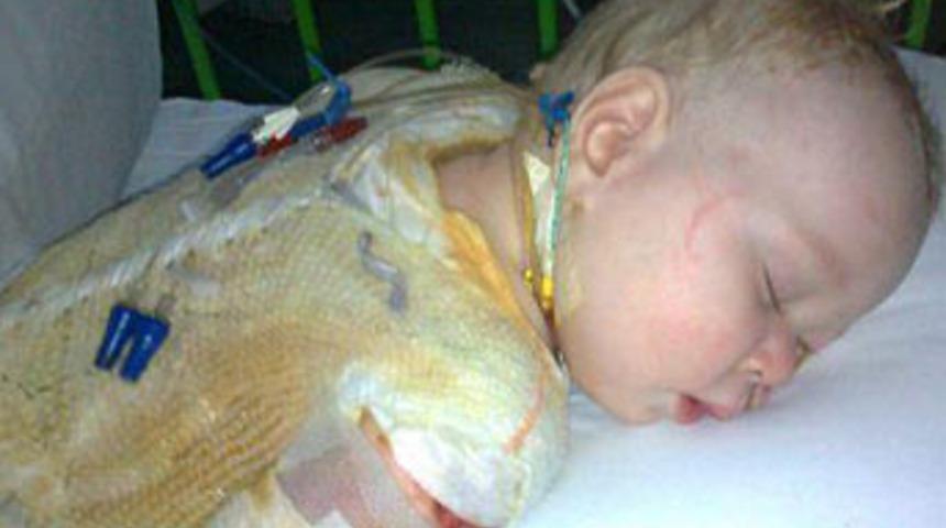 Bir damla çay, ölümüne neden oluyordu