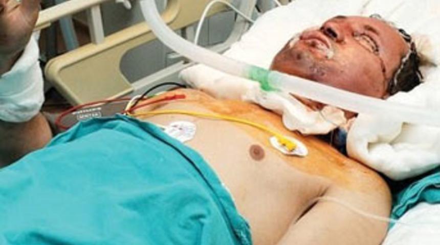 Yeni y&uuml;z&uuml; i&ccedil;in tercihi top sakal