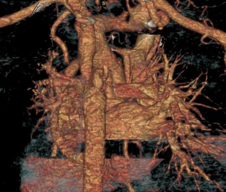 Tıp literatüründe nadir: 10 binde bir görülüyor! Sağlık raporu almaya gitti hayatının şokunu yaşadı G1