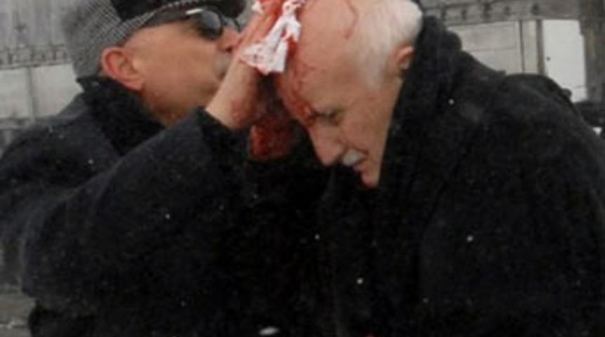 AKP Milletvekillerinin aracı kaza yaptı