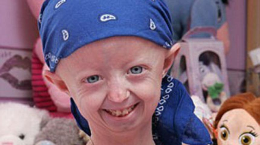 Vücudu 105, kendisi 14 yaşında!