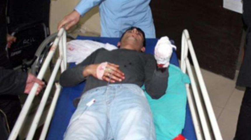 Polise atacağı bomba elinde patladı