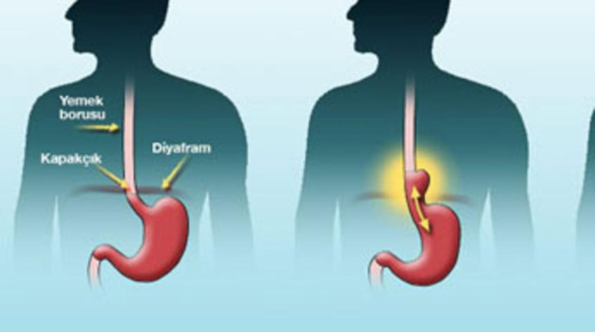 Refl&uuml; ila&ccedil;ları bir işe yaramıyor