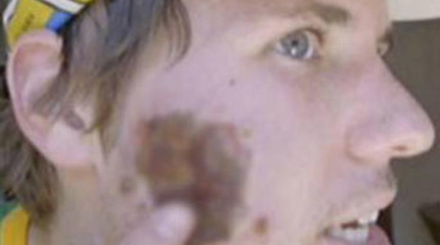 Bir ısırık hayatını mahvetti!