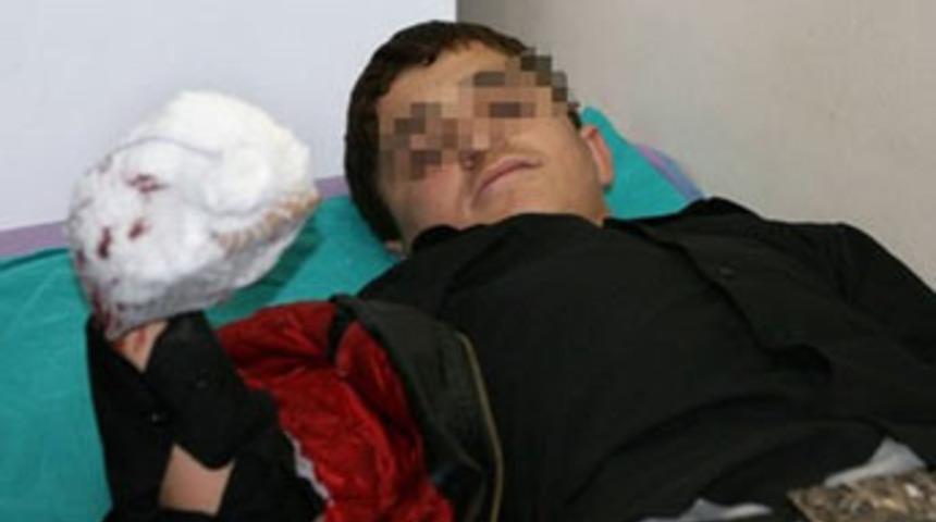 Polise atmak istediği bomba elinde patladı