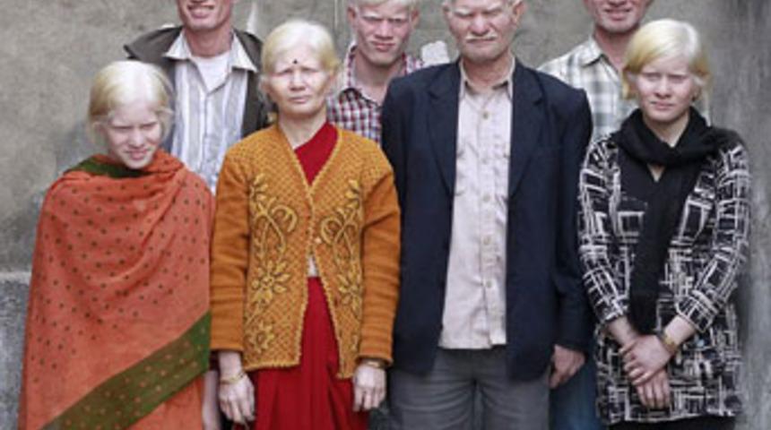 D&uuml;nyanın en b&uuml;y&uuml;k 'albino' ailesi!