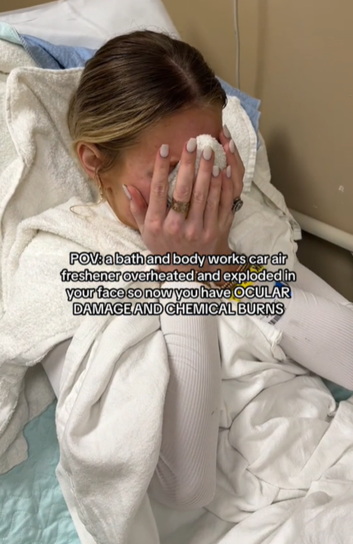 Oda spreyi bir anda patlayan kadın hastanelik oldu! O anları sosyal medyadan paylaşınca gündem yarattı G2