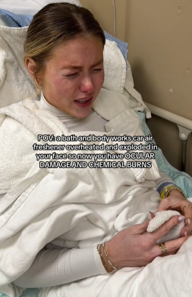 Oda spreyi bir anda patlayan kadın hastanelik oldu! O anları sosyal medyadan paylaşınca gündem yarattı G4