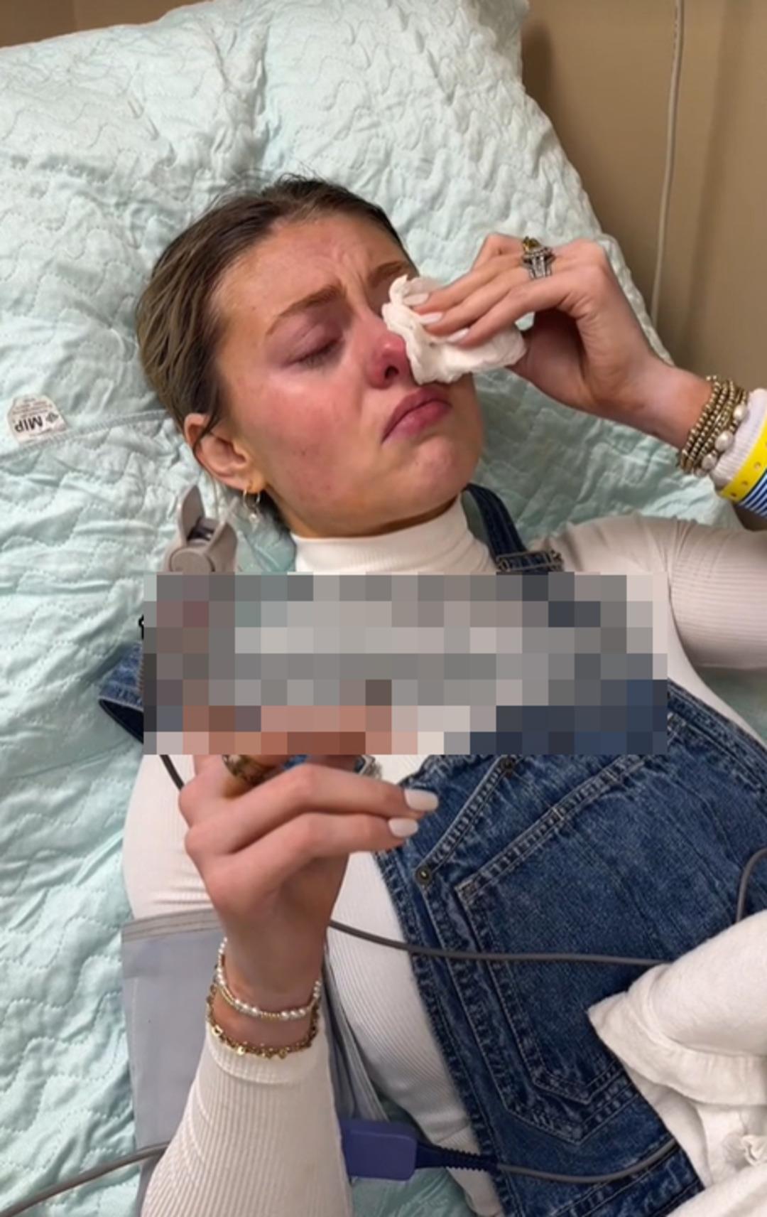 Oda spreyi bir anda patlayan kadın hastanelik oldu! O anları sosyal medyadan paylaşınca g&uuml;ndem yarattı