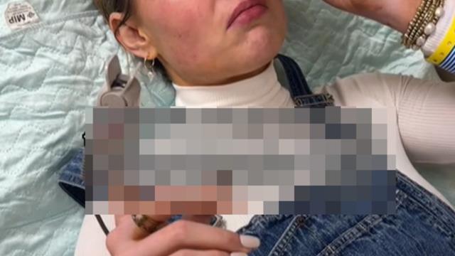 Oda spreyi bir anda patlayan kadın hastanelik oldu! O anları sosyal medyadan paylaşınca gündem yarattı