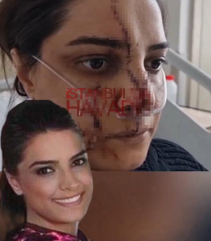 Yüzüne 40 dikiş atıldı, dehşet anlarını anlattı! Marmaray'daki kadın görevliye bıçaklı saldırı...2 yıldır peşini bırakmıyormuş: 'Defalarca şikayetçi oldum ama...' G3