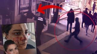 Yüzüne 40 dikiş atıldı, dehşet anlarını anlattı! Marmaray'daki kadın görevliye bıçaklı saldırı...2 yıldır peşini bırakmıyormuş: 'Defalarca şikayetçi oldum ama...'