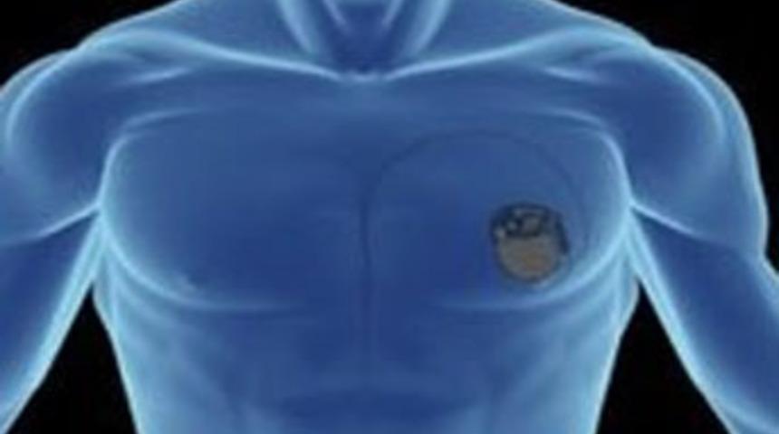 İmplantlara hacker uyarısı