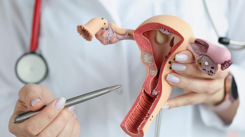 30 yaş üzeri kadınlarda risk daha yüksek! Bu basit işlem ile kanser riskini azaltın