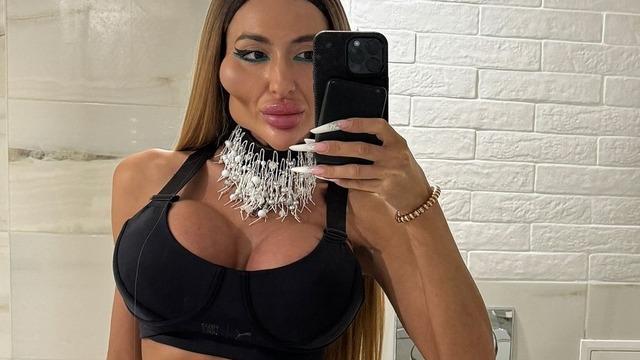 'Dünyanın en büyük yanaklarına' sahip kadın görünüşüyle ​​dalga geçen trollere cevap veriyor