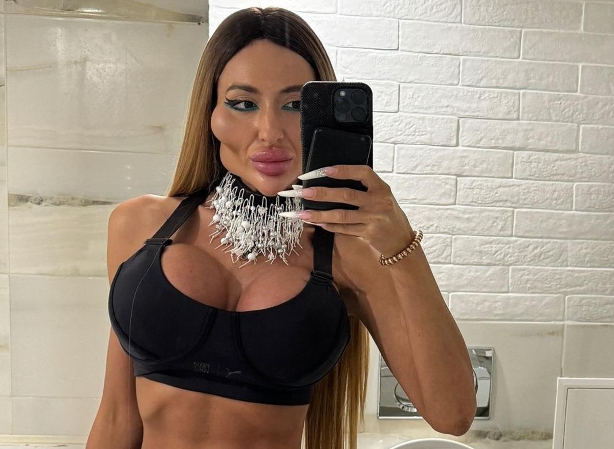 'D&uuml;nyanın en b&uuml;y&uuml;k yanaklarına' sahip kadın g&ouml;r&uuml;n&uuml;ş&uuml;yle ​​dalga ge&ccedil;en trollere cevap veriyor