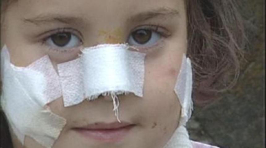 Küçük Sudenaz'ı bu hale bir horoz getirdi!