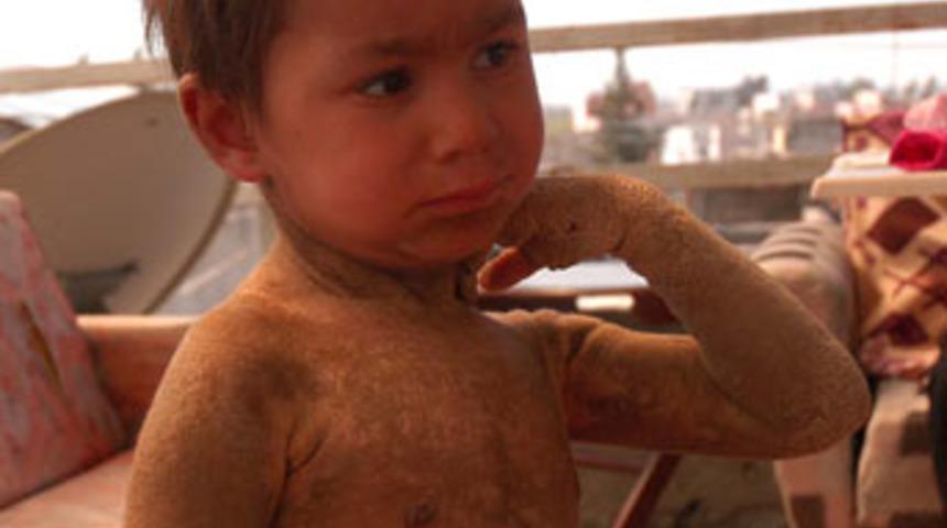 Dila k&uuml;&ccedil;&uuml;k, acısı b&uuml;y&uuml;k!