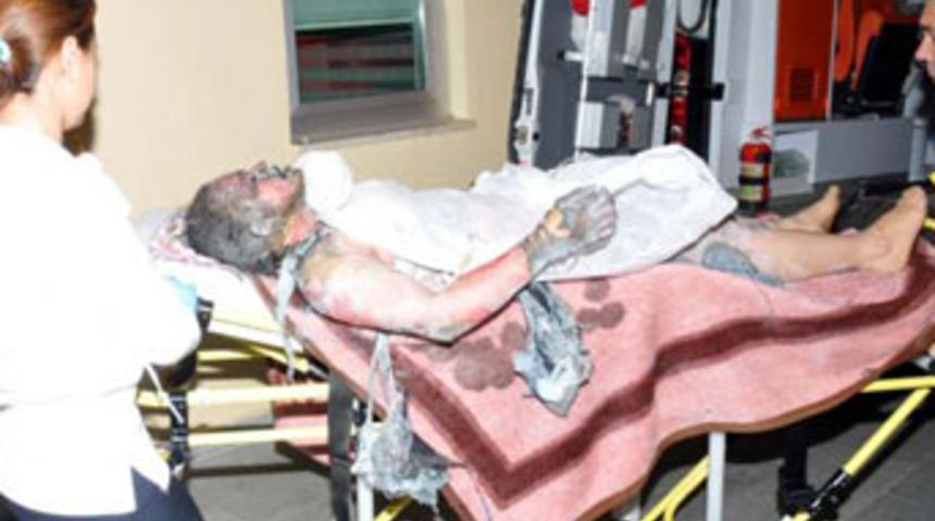 Genç kız benzinle kendini yaktı!