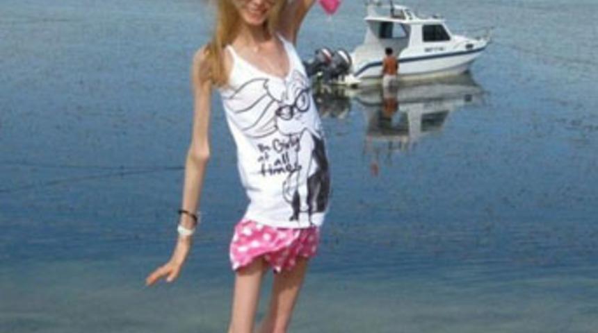 20 yaşında 20 kilo!