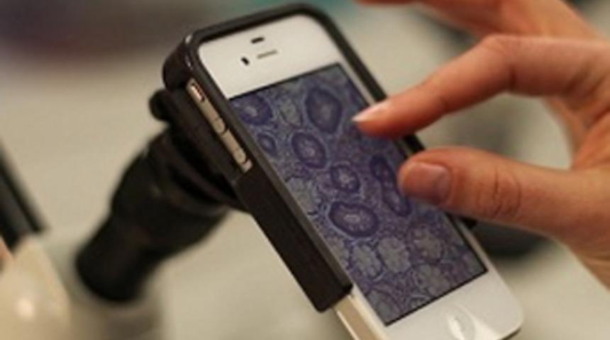 iPhone&rsquo;unuzu Mikroskop&rsquo;a D&ouml;n&uuml;şt&uuml;r&uuml;n