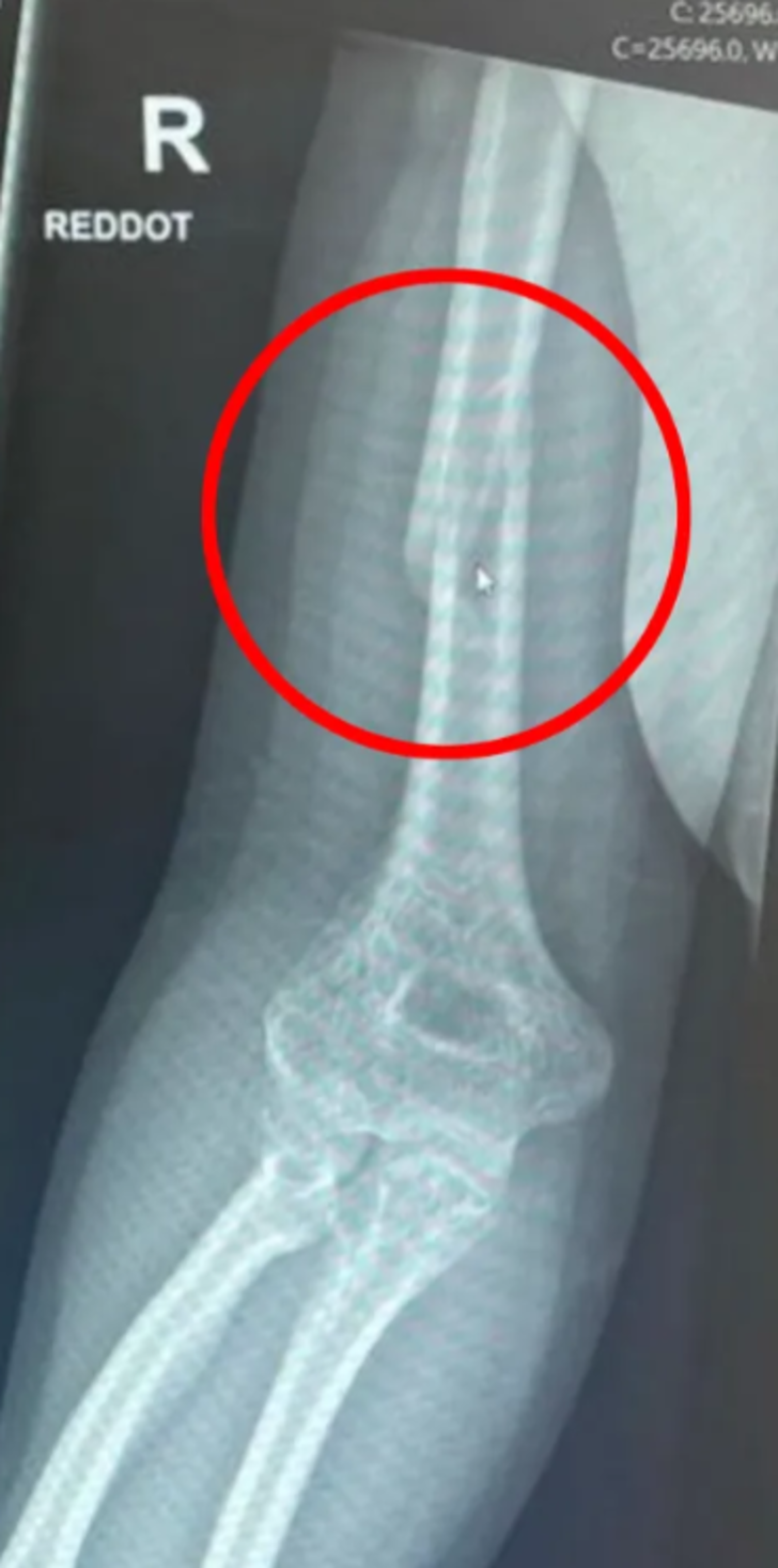 Tanımadığı adama meydan okuyarak bilek güreşi yapmak istedi! Sonu beklemediği gibi bitti... Hastanelik oldu G3