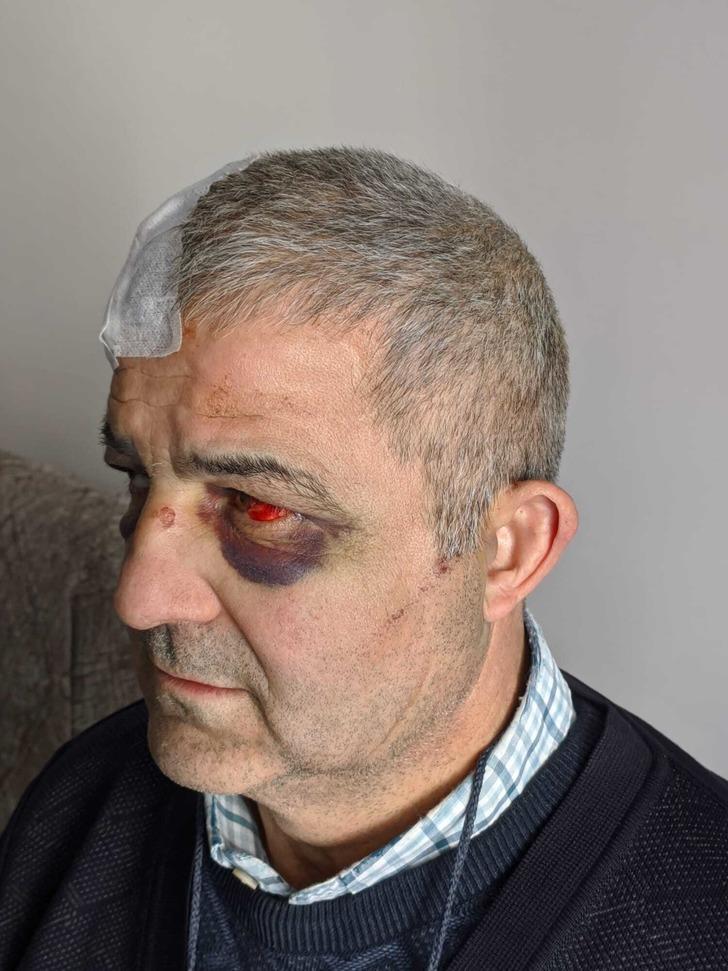 Gören de duyan da koştu, meydan muharebesine döndü! Esenyurt'ta esnafla motokuryelerin kavgasında çekiç ve sopalar havada uçuştu G3