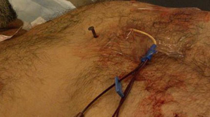 Kalbine &ccedil;ivi saplandı!