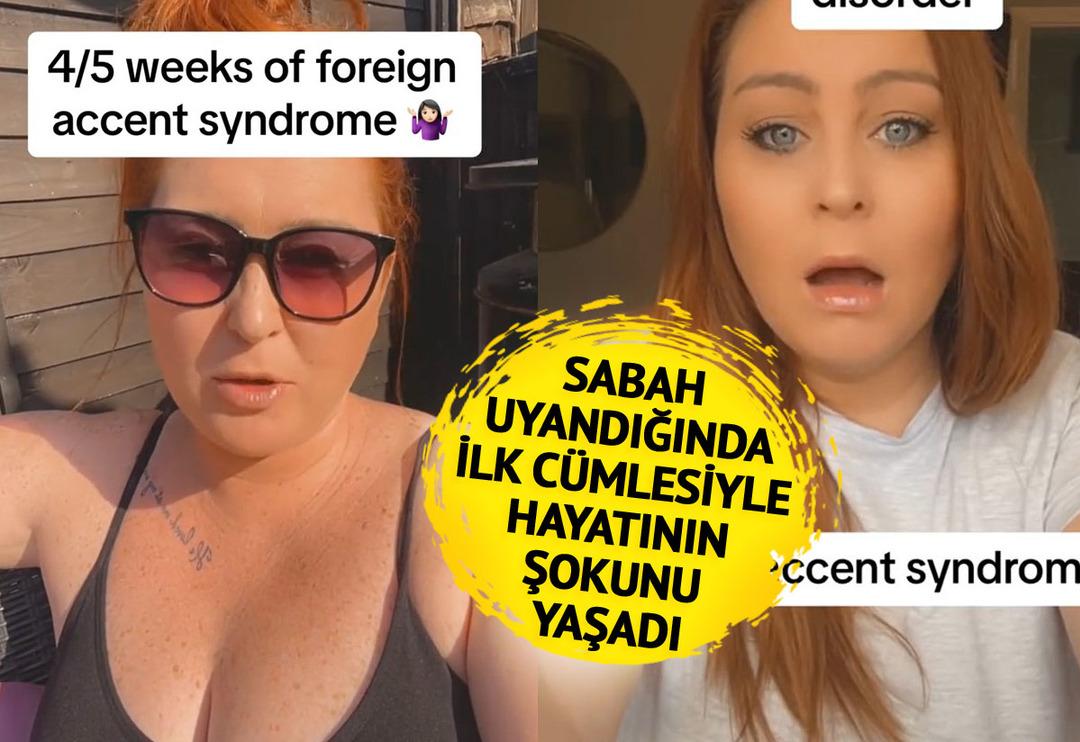 'Bir sabah uyandığımda hi&ccedil; gitmediğim &uuml;lkenin aksanıyla konuşmaya başladım' &Ccedil;ok nadir g&ouml;r&uuml;l&uuml;yor! 'Sesim bana ait değilmiş gibi'