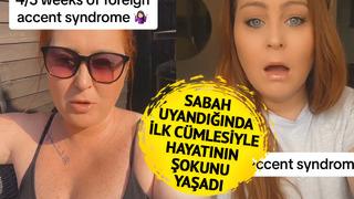 'Bir sabah uyandığımda hiç gitmediğim ülkenin aksanıyla konuşmaya başladım' Çok nadir görülüyor! 'Sesim bana ait değilmiş gibi'