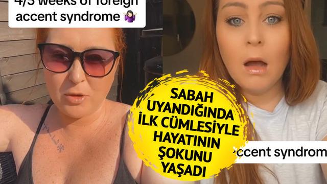 'Bir sabah uyandığımda hiç gitmediğim ülkenin aksanıyla konuşmaya başladım' Çok nadir görülüyor! 'Sesim bana ait değilmiş gibi'