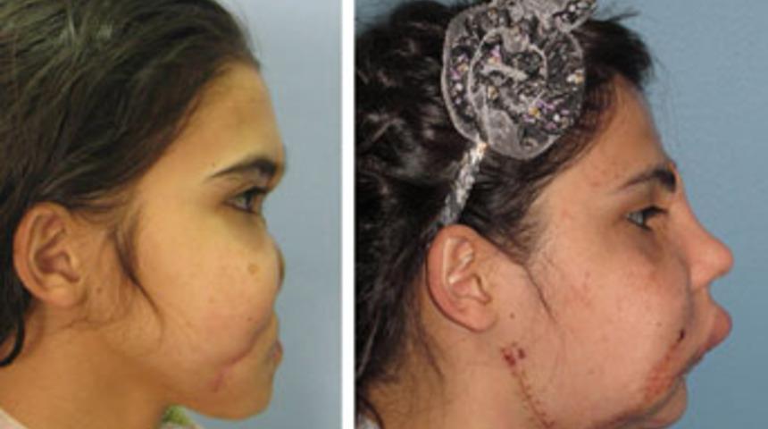 Nergis yeni yüzünü beğendi