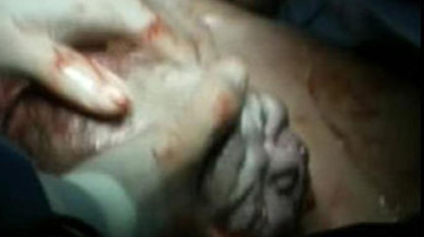 Canlı yayında sans&uuml;rs&uuml;z doğum