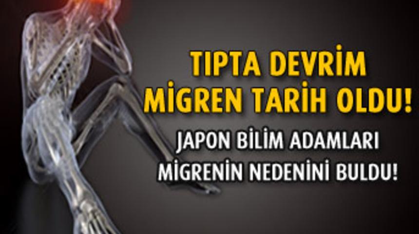 Migren Tarih Oldu!