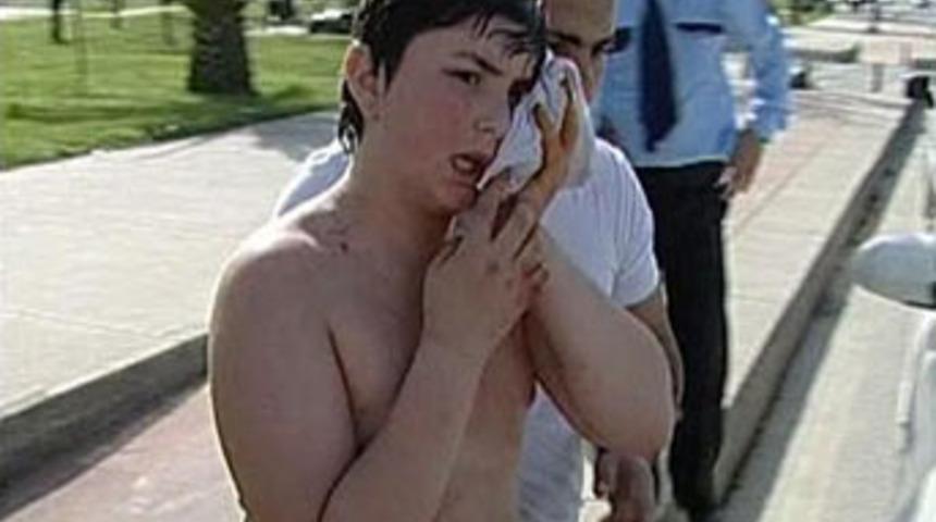 Denizde pitbull saldırısı