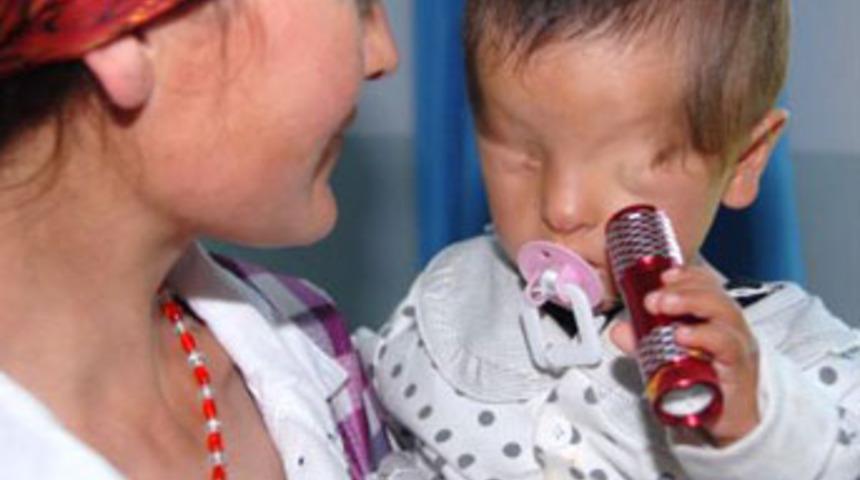 Gözleri doğuştan yok ama...