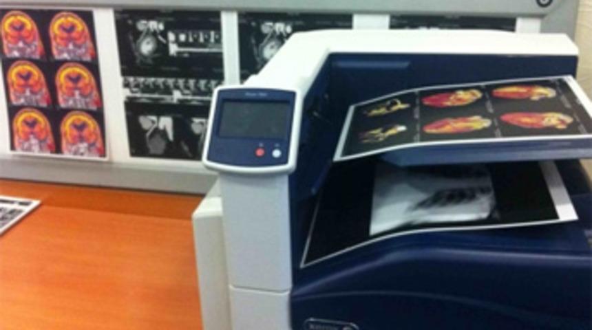 Röntgen Filmleri Kağıda Basılacak