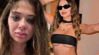 Merve Taşkın sevgilisinden şiddet gördü! Fenomenin yaralı kolları ve bacakları gündemde... Tehlikeli yerlerime fazlasıyla vuruyordu