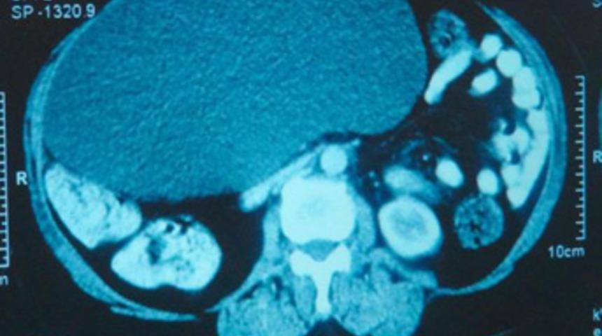 'Bir şeyin yok' dediler...