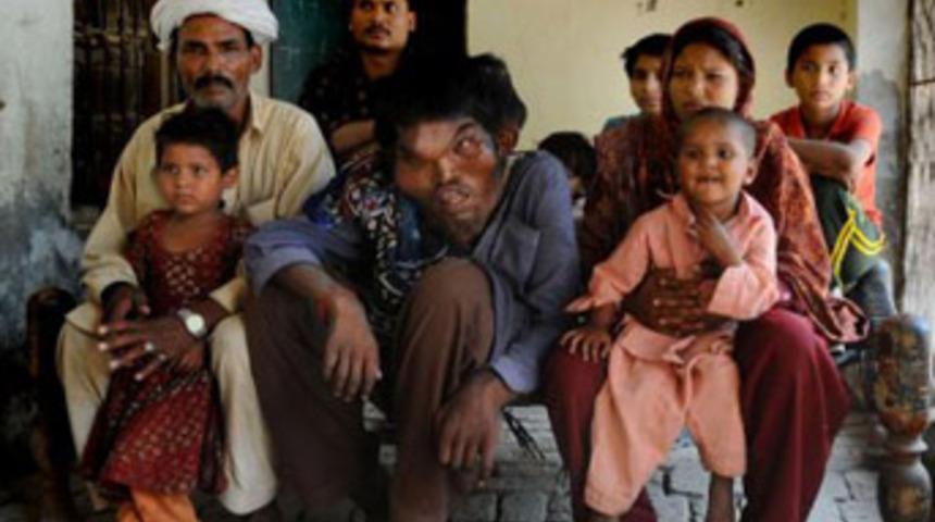 Vücudu hiç durmadan büyüyor!