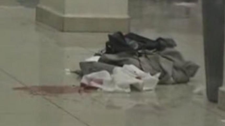 Yemek yerken başından vuruldu