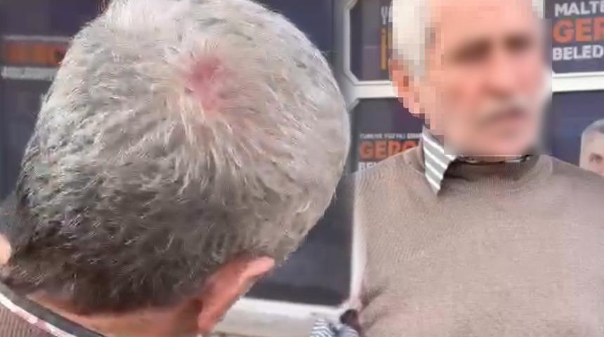 Yer: İstanbul! Broşür dağıtan AK Partiliyi darp etmişlerdi: 6 kişiye gözaltı