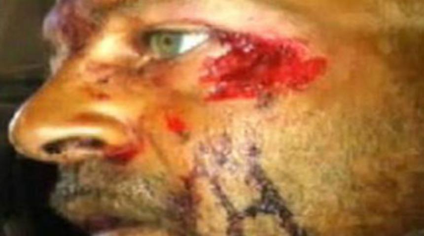 ABD&rsquo;de iki &lsquo;yamyam&rsquo; saldırısı daha