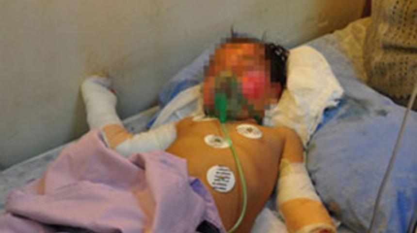 Tandıra d&uuml;şen Nazlıcan &ouml;ld&uuml;!