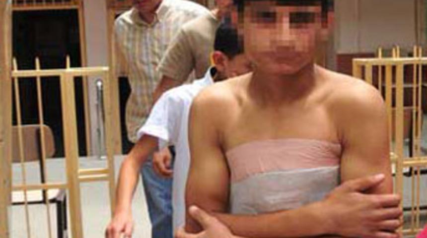 Polise atmak istedi, elinde patladı