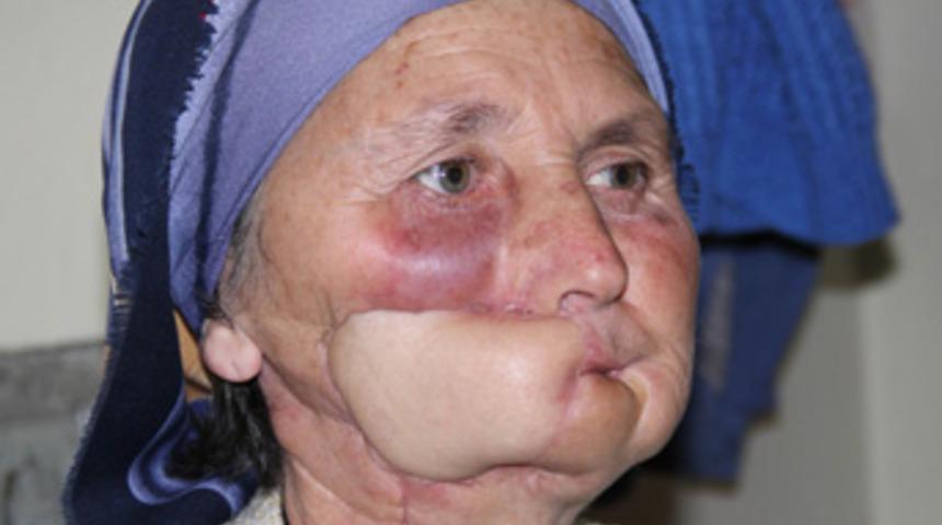 Bacağı yanağı, kemiği &ccedil;enesi oldu!