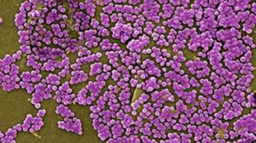 Antibiyotik kalmayabilir