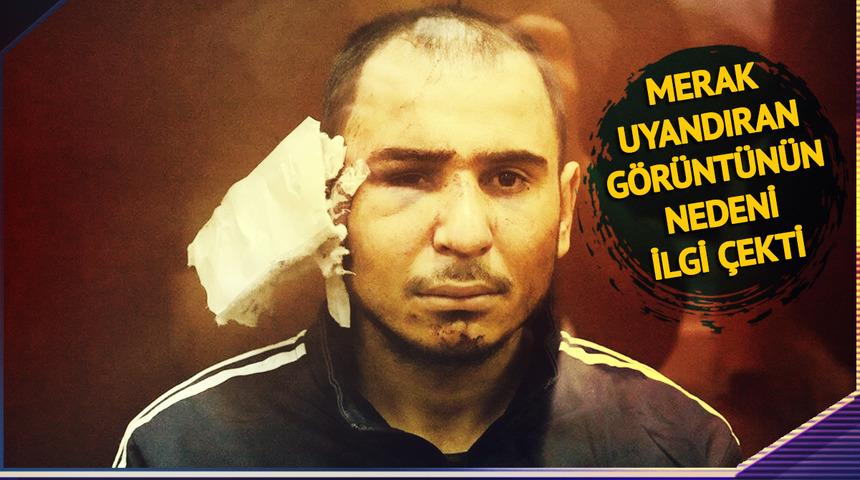 Onu kulağı kesik halde gören herkes aynı soruyu sordu! Teröristin merak uyandıran görüntüsü: Hem utanç verici hem aşağılayıcı